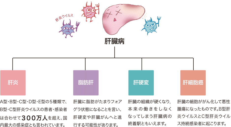 肝臓病は、肝炎・脂肪肝・肝硬変・肝細胞癌の４種に分類されます。
